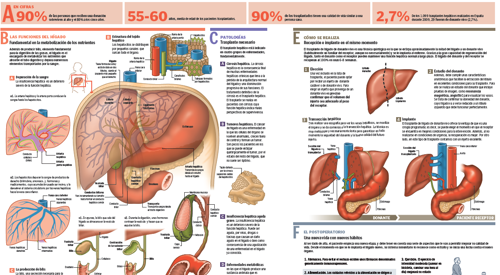 Trasplante hepático de donante vivo Imagen preview del infográfico sobre el trasplante hepático de donante vivo