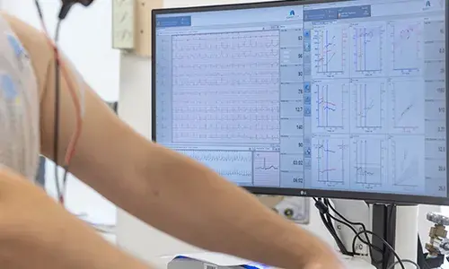 Imagen de una prueba de esfuerzo. CUN Imagen de un paciente realizándose una prueba de esfuerzo. CUN