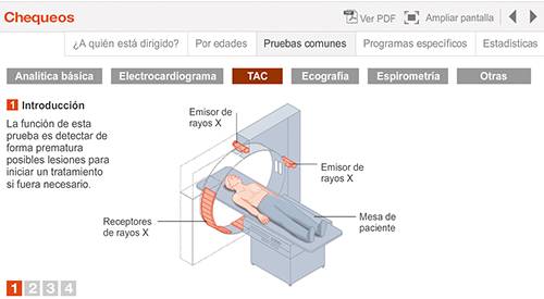 img-preview-animacion-chequeo
