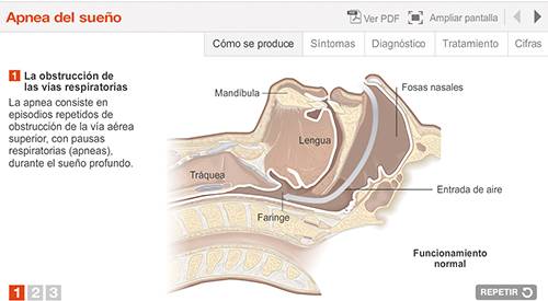 img-animacion-saos