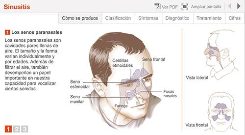 img-animacion-sinusitis