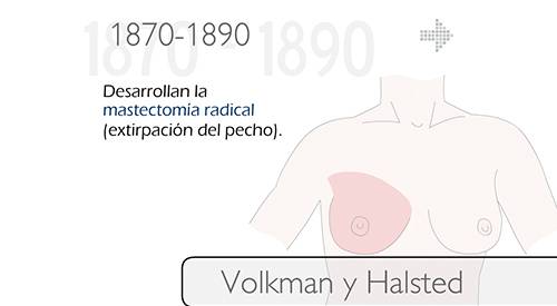 img-animacion-historia-cancer-mama