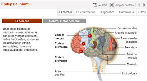 img-animacion-epilepsia-infantil