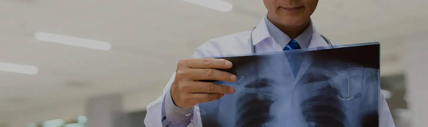 banner-radiografia-torax