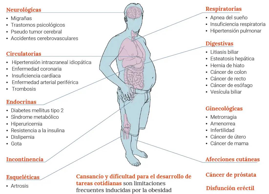 infografico-consecuencias-obesidad