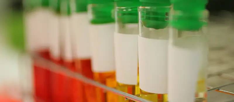 img-destacado-analisis-microbiologia