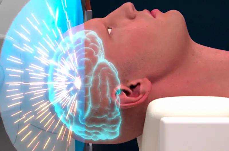 Temblor Esencial : Usamedic Neurologia Temblor Esencial Facebook : Es el trastorno del movimiento más frecuente.