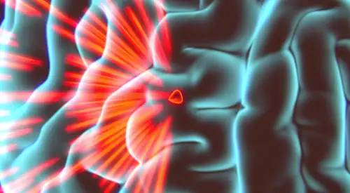img-preview-hifu-objetivo-ultrasonidos