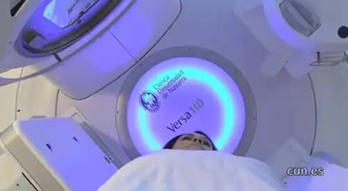 radioterapia-versahd