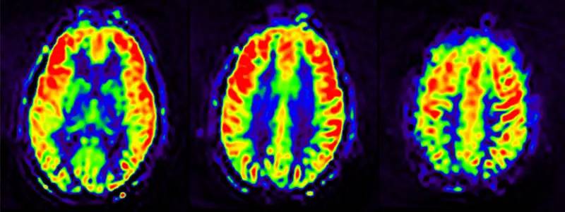 imagen-neurologica