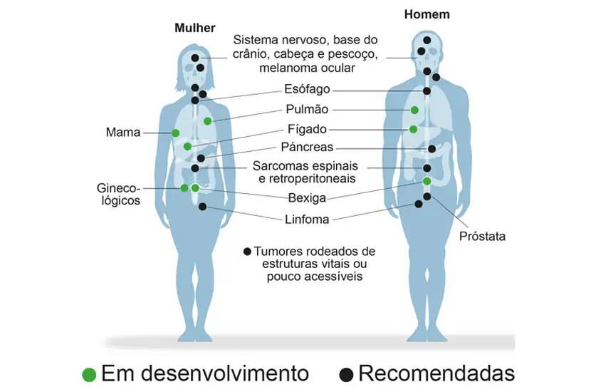 img-indicacao-protonterapia-adulto