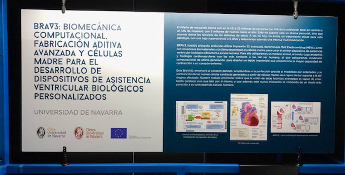 proyecto-brave-exposicion-museo-MUNCYT Imagen del panel de exposición del proyecto BRAVE de la Clínica Universidad de Navarra en el Museo Nacional de Ciencia y Tecnología.
