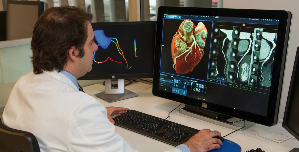 coronografia-chequeo-cardiovascular Imagen de una coronografía, prueba incluida en el Chequeo Cardiovascular ofrecido por la Clínica Universidad de Navarra.