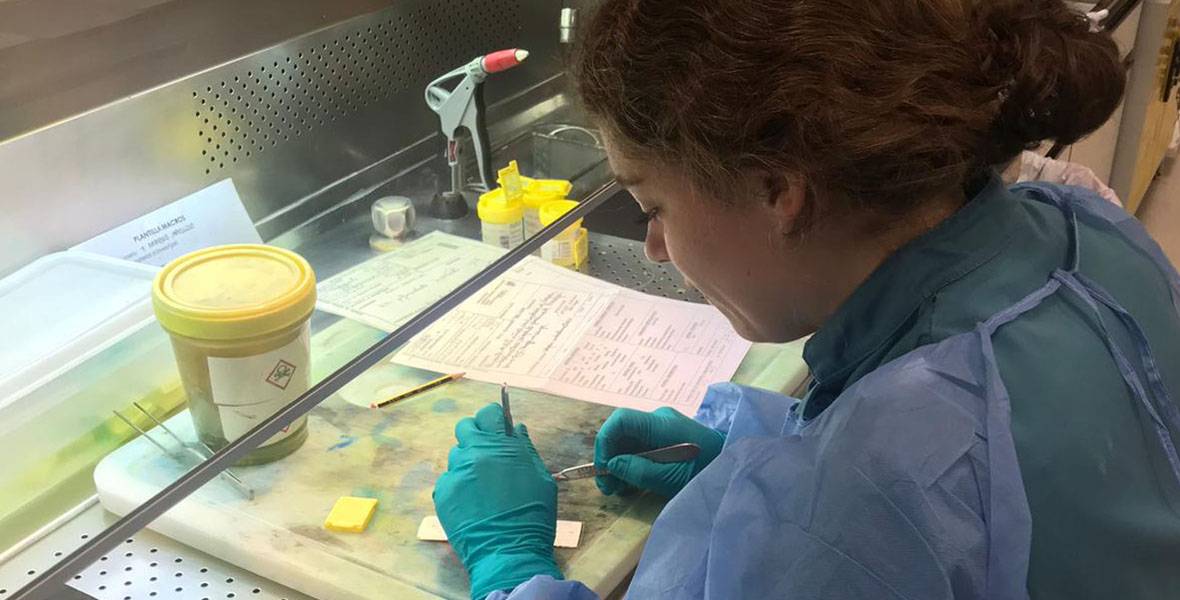 dra-alejandra-tomas-dermatologia La Dra. Alejandra Tomás, especialista del Departamento de Dermatología de la Clínica Universidad de Navarra, durante la investigación de su tesis.