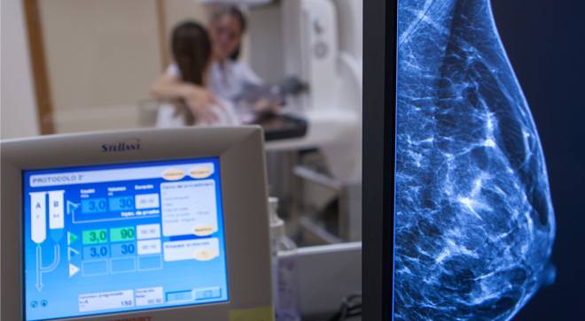 investigacion-cancer-mama Imagen de una mamografía en relación a la investigación en cáncer de mama en la que colabora la Clínica Universidad de Navarra.
