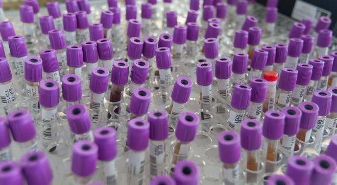 muestras-oneome Imagen de unas muestras de sangre de los laboratorios de la Clínica Universidad de Navarra.