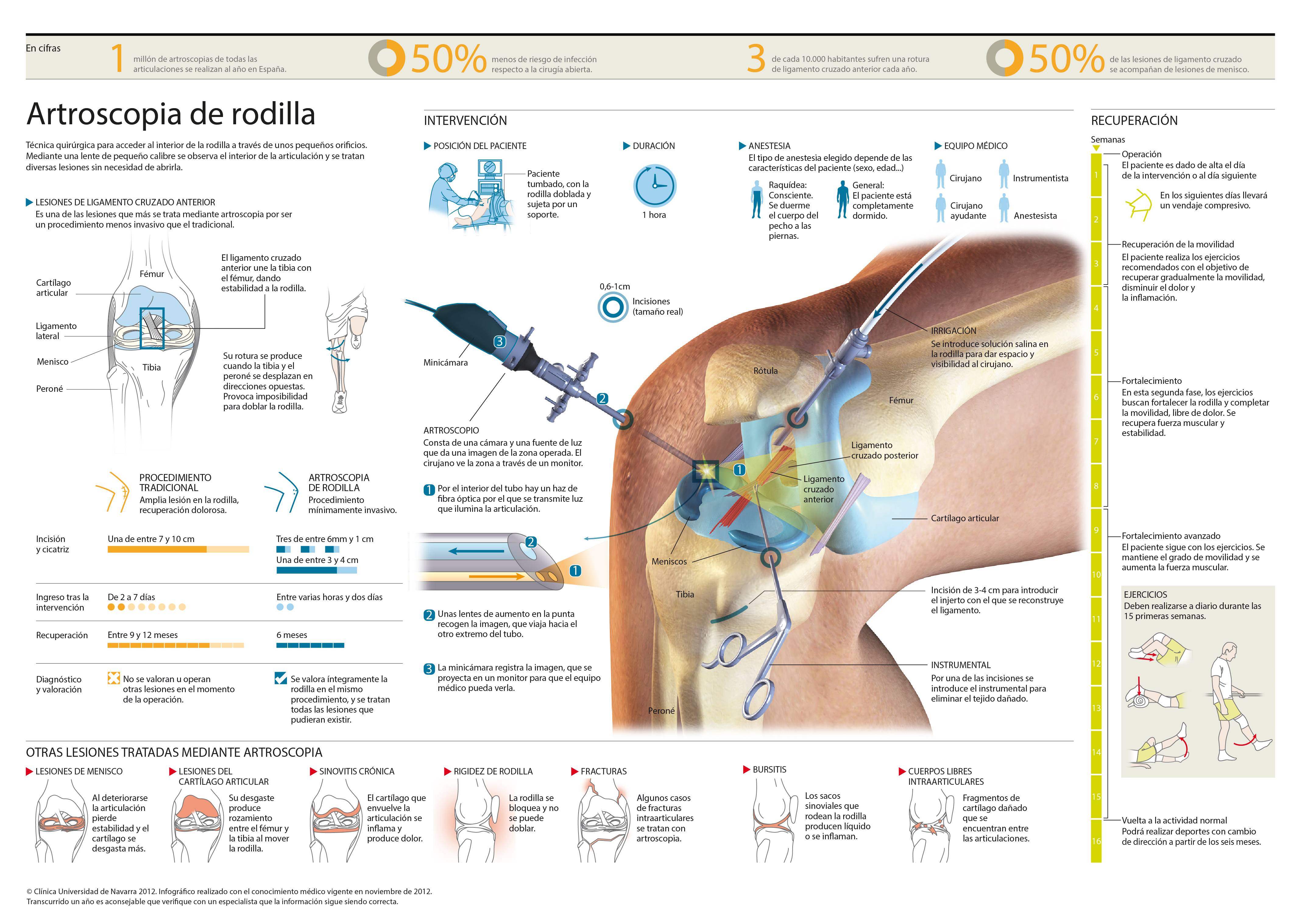2012-artroscopia-rodilla-max <p>Conozca qué es la artroscopia de rodilla y en qué problemas de la rodilla se realiza. </p>