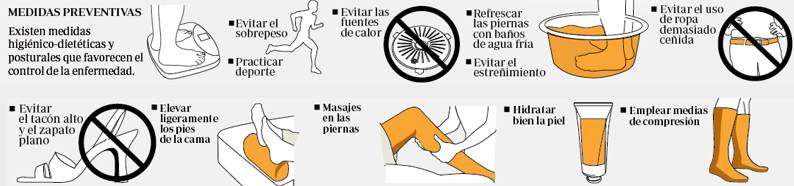 <p>Consejos para mejorar y prevenir los edemas&nbsp;</p>