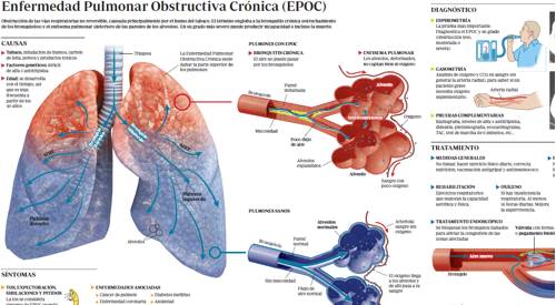 Infográfico epoc