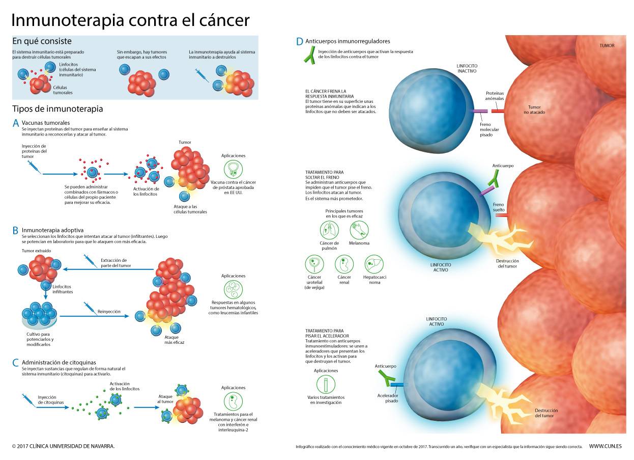 Imagen de la infografía sobre inmunoterapia y cáncer de la Clínica Universidad de Navarra