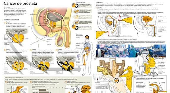 Que se puede detectar en una biopsia