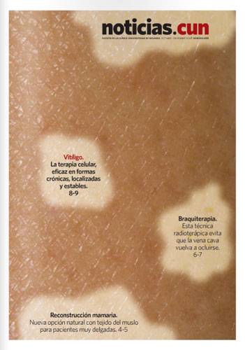 Portada del nº 66 de la Revista NoticiasCUN de la Clínica Imagen de la portada de la revista nº 66 NoticiasCUN de la Clínica Universidad de Navarra