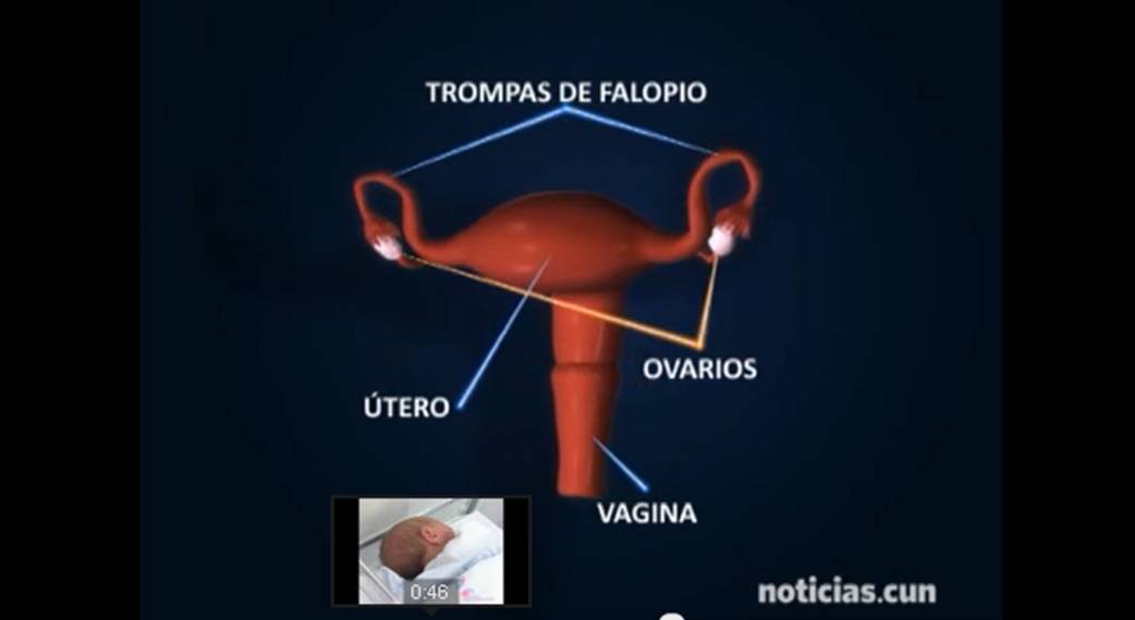 Reversión de ligadura de trompas Se calcula que un 15% de las mujeres que han sido sometidas a una intervención de ligadura de trompas desean volver a tener hijos. En la Clínica Universidad de Navarra se lleva a cabo un procedimiento de reversión de ligadura de trompas que ofrece más de un 55% de éxito de embarazos. Mediante la reversión de trompas, la concepción de un hijo ocurre de forma natural, sin limitación alguna de ciclos de tratamiento.
