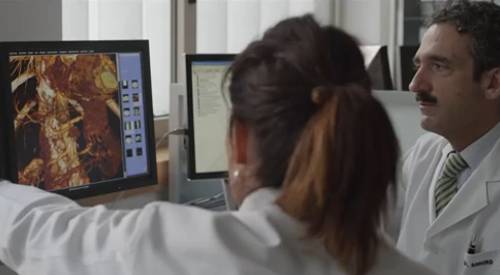 Radioembolización con esferas de Ytrio-90, 10 años de experiencia El tratamiento con microesferas de Ytrio-90 consigue el control local del cáncer hepático en más del 80% de los casos. La Clínica Universidad de Navarra cumple 10 años como centro pionero en la utilización de este procedimiento, indicado principalmente para el tratamiento de los tumores de hígado. Es el centro médico español que acumula mayor experiencia en esta terapia, que ya ha aplicado en más de 400 pacientes.
