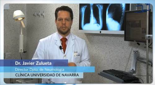 10 razones para dejar de fumar El Dr. Zulueta, director del Departemento de Neumología, da 10 razones por las que dejar de fumar, entre ellas, disminuir el riesgo de sufrir cáncer de pulmón o de sufrir un infarto.