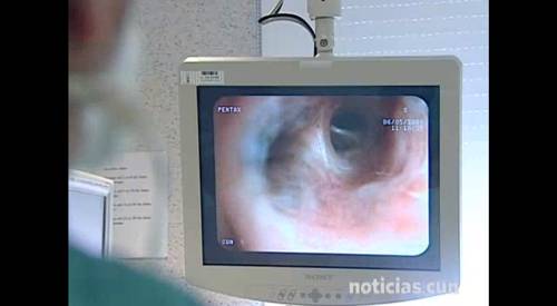 Broncoscopio guiado por navegación electromagnética El broncoscopio guiado consigue biopsiar sin punción ni cirugía el 75% de los nódulos pulmonares de más de 2 cm. La broncoscopia es una prueba diagnóstica que permite visualizar la vía respiratoria (laringe, tráquea y bronquios de mayor tamaño) y recoger muestras de secreciones respiratorias, tejido bronquial o pulmonar o ganglios del mediastino.