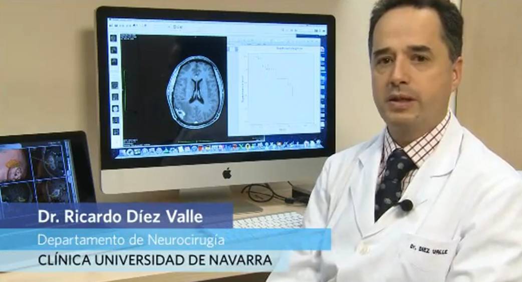 Vacunas contra el glioblastoma (tumor cerebral agresivo) En qué consiste el glioblastoma y la dificultad para eliminarlo, pese a la radioterapia. La Clínica es el único centro español que realiza un estudio para el tratamiento de los glioblastomas con inmunoterapia. La nueva terapia, que se administra a los pacientes participantes en forma de vacunas, se combina con el tratamiento estándar de primera línea. Consiste en la extirpación quirúrgica del tumor, seguida de la administración de radioterapia y quimioterapia con temozolomida.