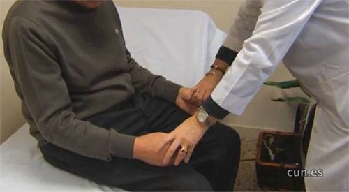 Cirugía del Parkinson y nuevas terapias de administración de fármacos Tras algunos años de enfermedad, los pacientes con Parkinson pueden ser candidatos a ser operados mediante una intervención denominada estimulación cerebral profunda. La cirugía de la enfermedad de Parkinson está indicada cuando el tratamiento farmacológico no logra controlar los síntomas del paciente durante todo el día, consigue mejoras en el movimiento, así como una disminución en la rigidez y los temblores de los pacientes. Además, existen nuevas técnicas avanzadas que garantizan de forma continua la administración de la medicación.