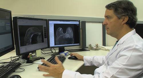 Braquiterapia, la radioterapia interna más corta y eficaz para el cáncer de mama Un estudio de especialistas de la Clínica Universidad de Navarra ha comprobado los buenos resultados del implante de catéteres durante la misma cirugía conservadora del cáncer de mama, para administrar irradiación parcial acelerada con braquiterapia en solo 5 días, frente a las 4-6 semanas de la radioterapia externa convencional. Según un estudio realizado por especialistas de la Clínica Universidad de Navarra (en más de 150 pacientes hasta la fecha), publicado recientemente en la revista oficial de la Sociedad Americana de Braquiterapia. Este procedimiento consigue radiar de forma muy precisa e intensa la zona de máximo riesgo de reaparición del tumor tras la intervención y salvaguarda de este modo el tejido sano: los órganos adyacentes -pulmón, corazón- y la mayor parte del tejido mamario sano, que no necesita ser radiado por tener un riesgo muy bajo de reaparición de un nuevo tumor.