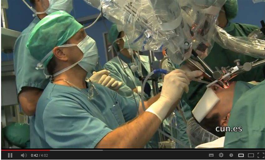 La Clínica realiza la primera operación en España por cavidad oral con el robot Da Vinci . El paciente, de origen brasileño, presentaba hipertrofia de la amígdala lingual y de la base de la lengua. El volumen excesivo de la amígdala lingual le provocaba una obstrucción parcial de la vía aérea y, como consecuencia, una apnea obstructiva del sueño. Este novedoso sistema quirúrgico, denominado Da Vinci®, es un sistema robótico asistido informáticamente que amplía la capacidad del cirujano para operar de manera menos invasiva. Consigue reducir en un 40% la estancia hospitalaria tras la intervención quirúrgica dado que los pacientes se recuperan mucho mejor de la intervención.