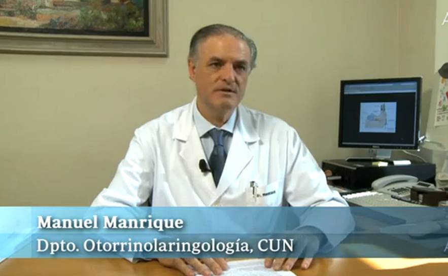 Implantes auditivos (cocleares) Te contamos la historia de Simón, que nació sordo pero hoy puede oir gracias a dos implantes cocleares. El implante coclear está indicado en pacientes que han perdido la audición antes (prelocutivos) o después (postlocutivos) de haber desarrollado el lenguaje y para sorderas graves o profundas. Un implante coclear es un dispositivo electrónico que sustituye al oído externo, medio e interno, capaz de recoger los sonidos, transformarlos en estímulos eléctricos para transmitirlos al nervio auditivo y restablecer el flujo de información auditiva que llega al cerebro.