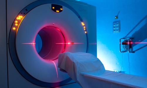 Imagen del PET-TAC de la Clínica Universidad de Navarra