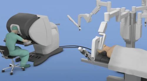 Cirugía robótica Da Vinci, tratamiento de la apnea del sueño