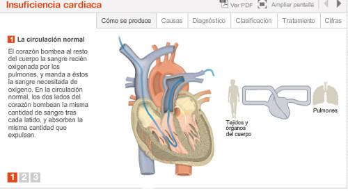 Imagen preview animación insuficiencia cardiaca. Departamento de Cardiología