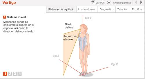 Imagen preview animación sobre vértigos y los trastornos del equilibrio que los ocasionan. Departamento de Otorrinolaringología.