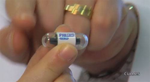 Cápsula para detectar el cáncer de colon. CUN