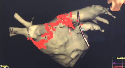 Corazón en 3D. CUN