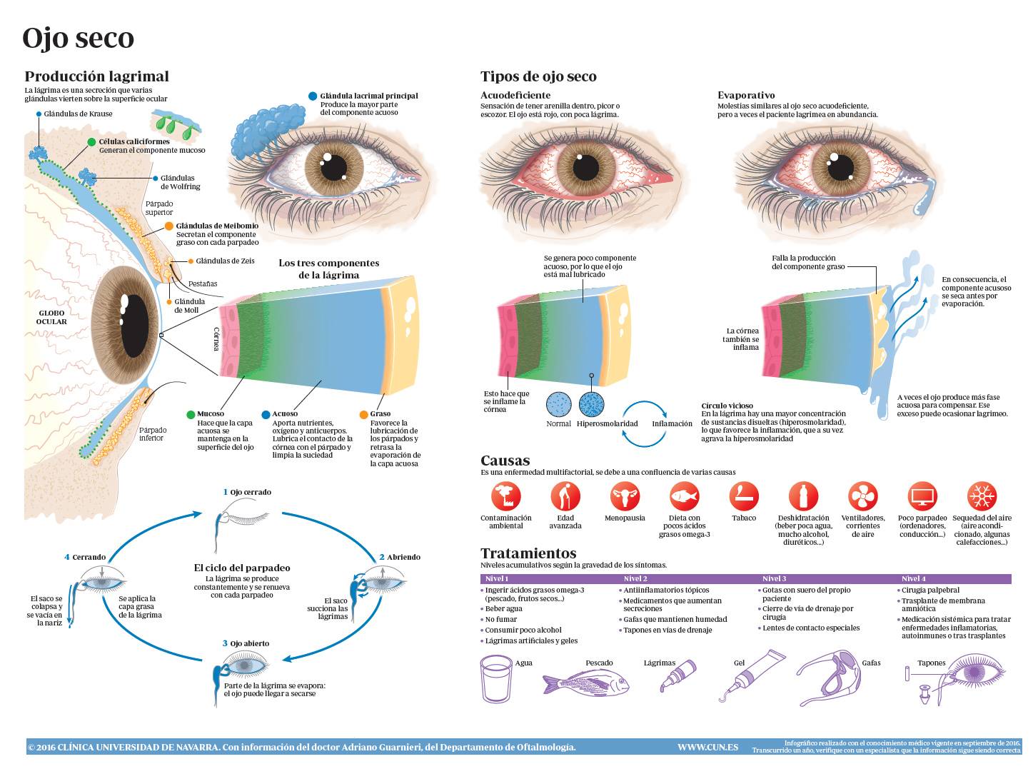 12 Consejos Para El Sindrome Del Ojo Seco Infografia Infographic Images