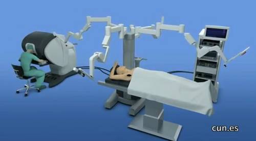 Cirugía de tiroides con robot da Vinci, técnica transaxilar. CUN
