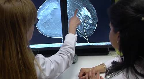 Estudio genético para el cáncer de mama hereditario La madre de Rosi falleció por cáncer de mama y su tía sufrió la misma enfermedad. Por ello Rosi quiso saber cuáles eran sus probabilidades de padecer cáncer de mama, una enfermedad hereditaria en el 5 y el 10% de los casos.