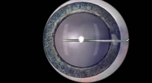 Habilidades básicas Imagen del simulador EyeSI para el entrenamiento del oftalmólogo