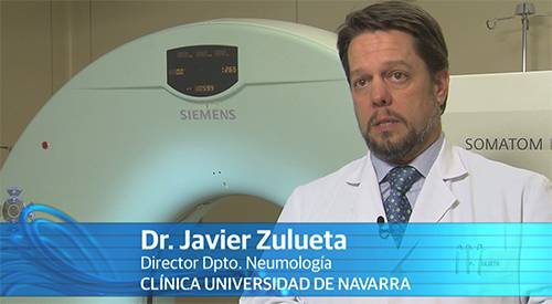 El TAC de baja dosis de radiación (escáner) detecta el cáncer de pulmón en estadio 1 en el 85% de los casos  según un estudio internacional, en el que participa la Clínica Universidad de Navarra, que aconseja la realización de la prueba anualmente.