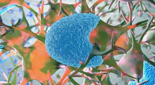 Por primera vez en el mundo, una nueva terapia que combina un virus modificado genéticamente con inmunoterapia se va a probar en pacientes. Un equipo de la Clínica Universidad de Navarra que aplicará el nuevo tratamiento contra el tumor cerebral más agresivo, el glioblastoma.
