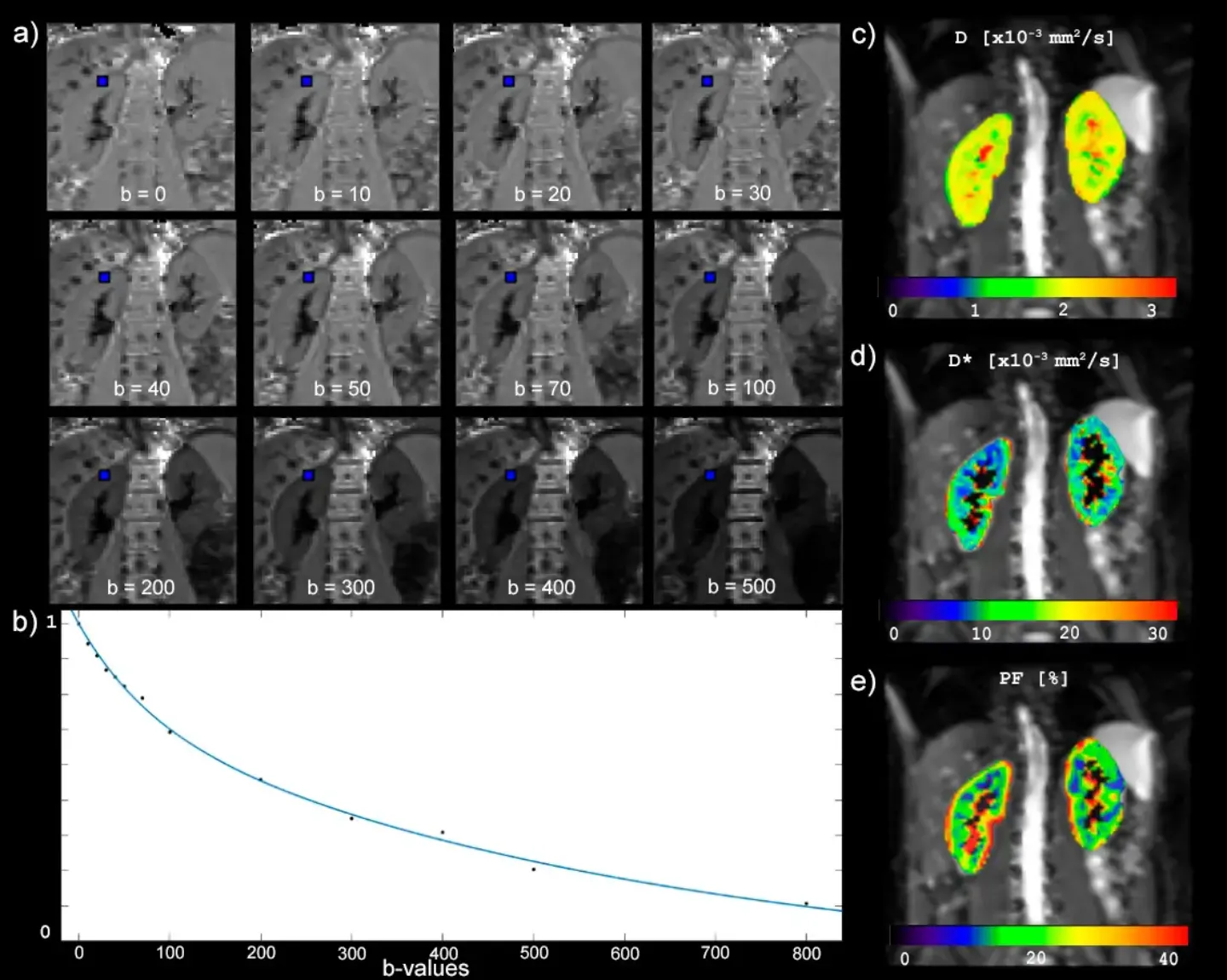 imagenes-difusion-gradiente-renal