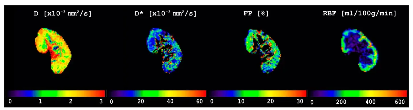 img-flujo-trasplante-renal