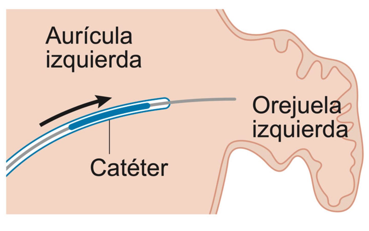 Toma Anticoagulantes Cl nica Universidad De Navarra toma-anticoagulantes-cl-nica-universidad-de-navarra